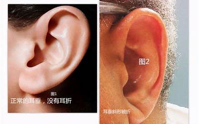 耳朵有折痕